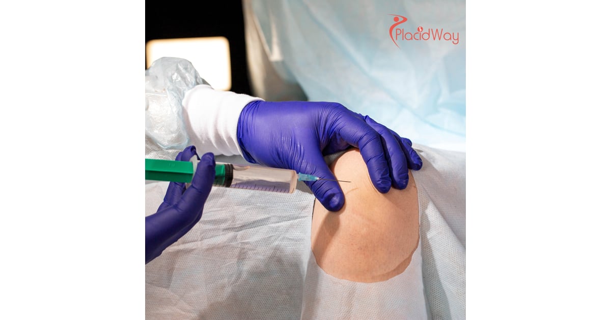Stem Cell Therapy for Cartilage Regeneration in Mexico: A Cost-Effective Solution for Canadians