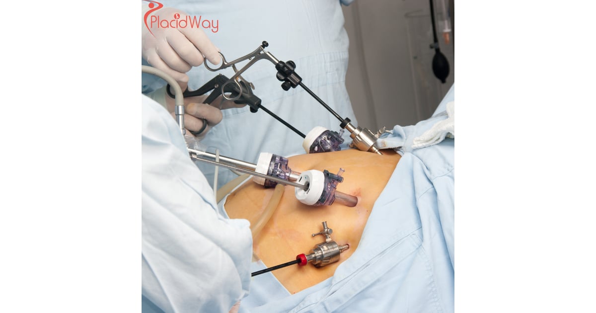 Gastric Bypass Surgery in Mexico: A Cost-Effective Weight Loss Solution for Canadians