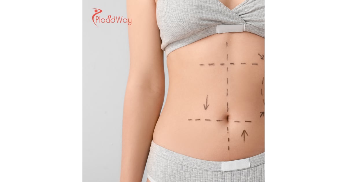 Liposuction in Turkey: Why Canadians are Choosing Turkey for Affordable Body Sculpting