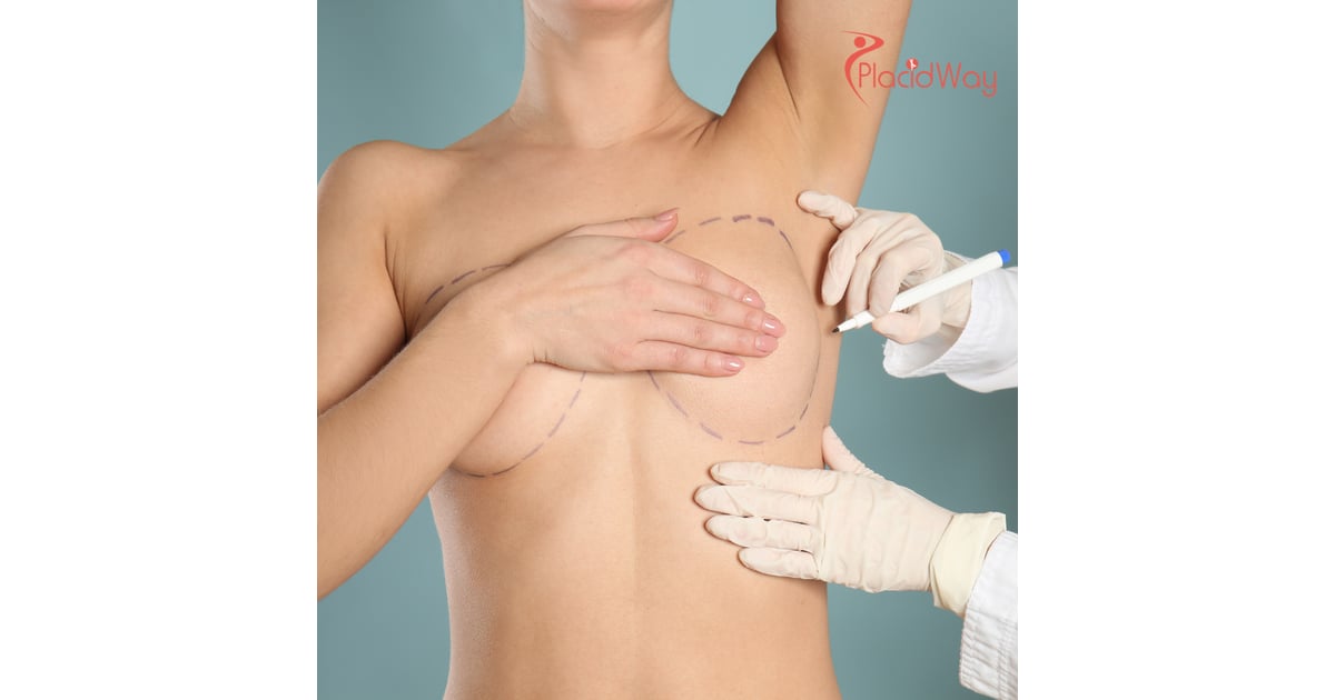 Breast Augmentation in Thailand: Achieve Your Desired Look with Affordable Care for Australian Women