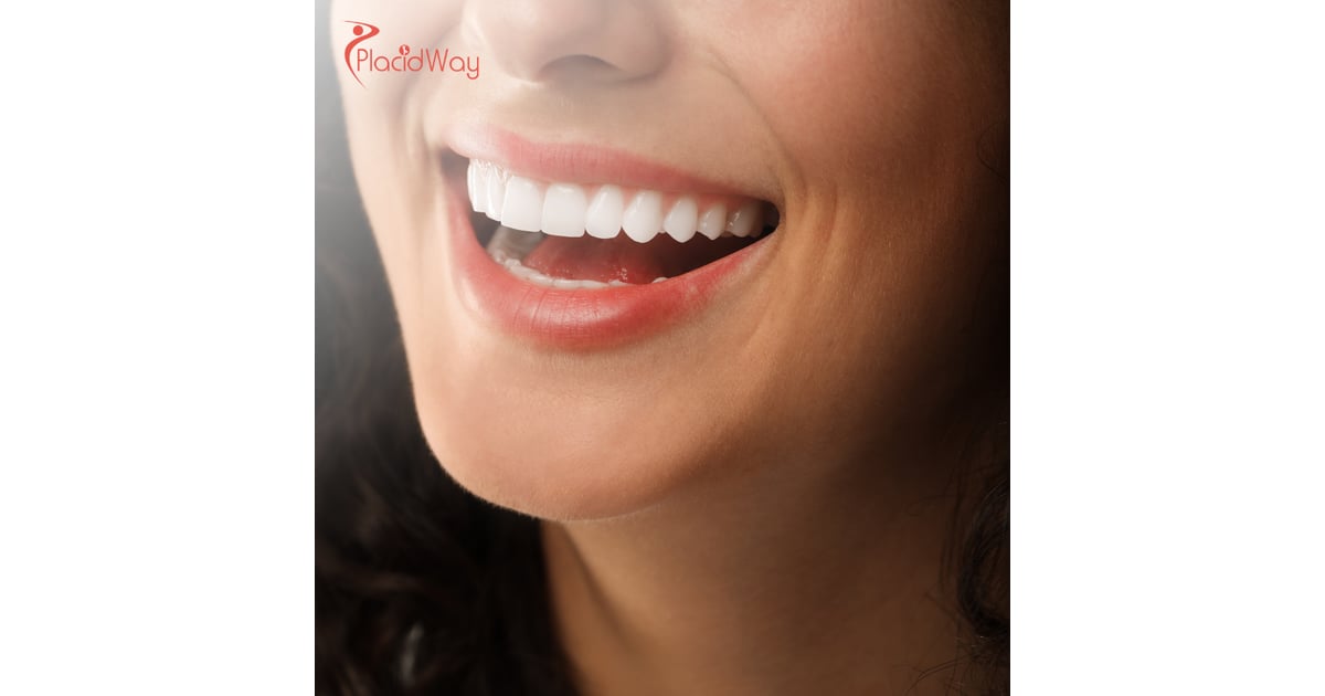 Porcelain Veneers in Turkey: Achieve the Perfect Smile with Expert Dental Treatments for Australians