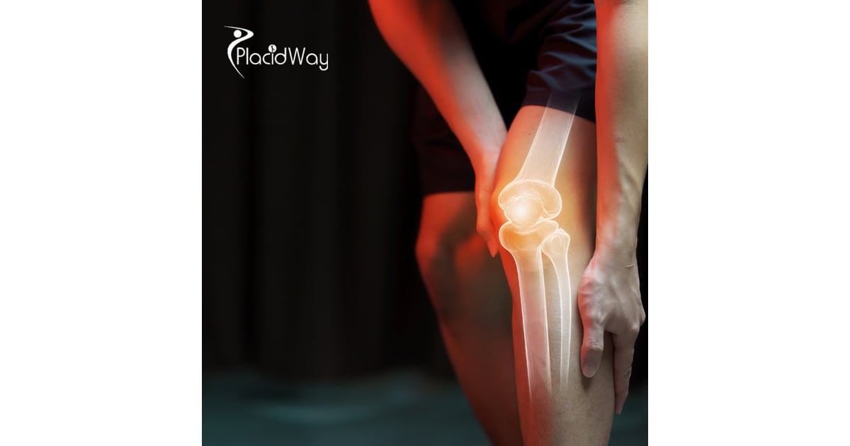 Arthroscopic Knee Surgery in Turkey: Affordable and Advanced Solutions for Australian Tourists