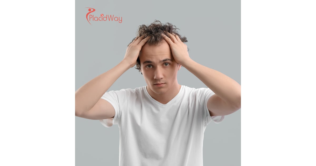 FUE Hair Transplantation in Turkey: Affordable and World-Class Hair Restoration for Australian Tourists