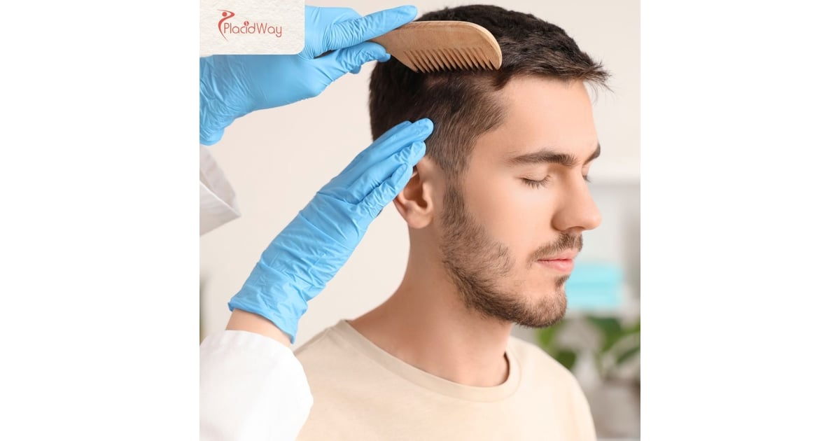 DHI Hair Transplant in Istanbul: A UK Patient’s Guide to Cost and Procedure