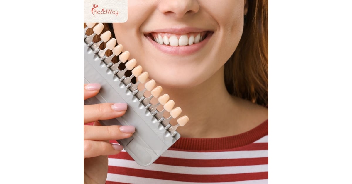 E-Max Veneers in Turkey: The Ultimate Guide to a Flawless Smile Makeover