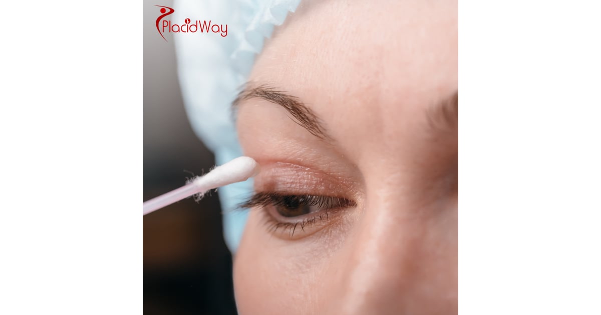 Eyelid Surgery in Turkey: Cost and Clinic Comparison for Brits