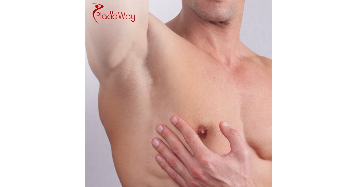 Gynecomastia Surgery for Men in Turkey: A UK Patient’s Cost and Procedure Guide