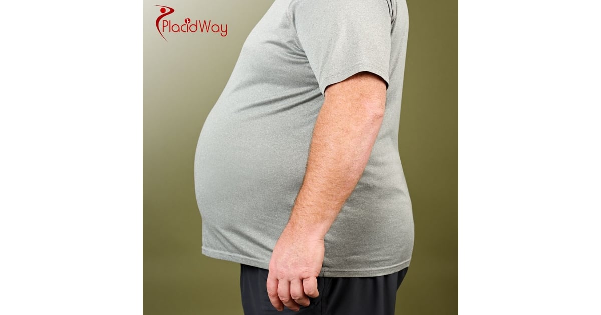 Gastric Bypass in Turkey: Understanding the Procedure and Long-Term Success
