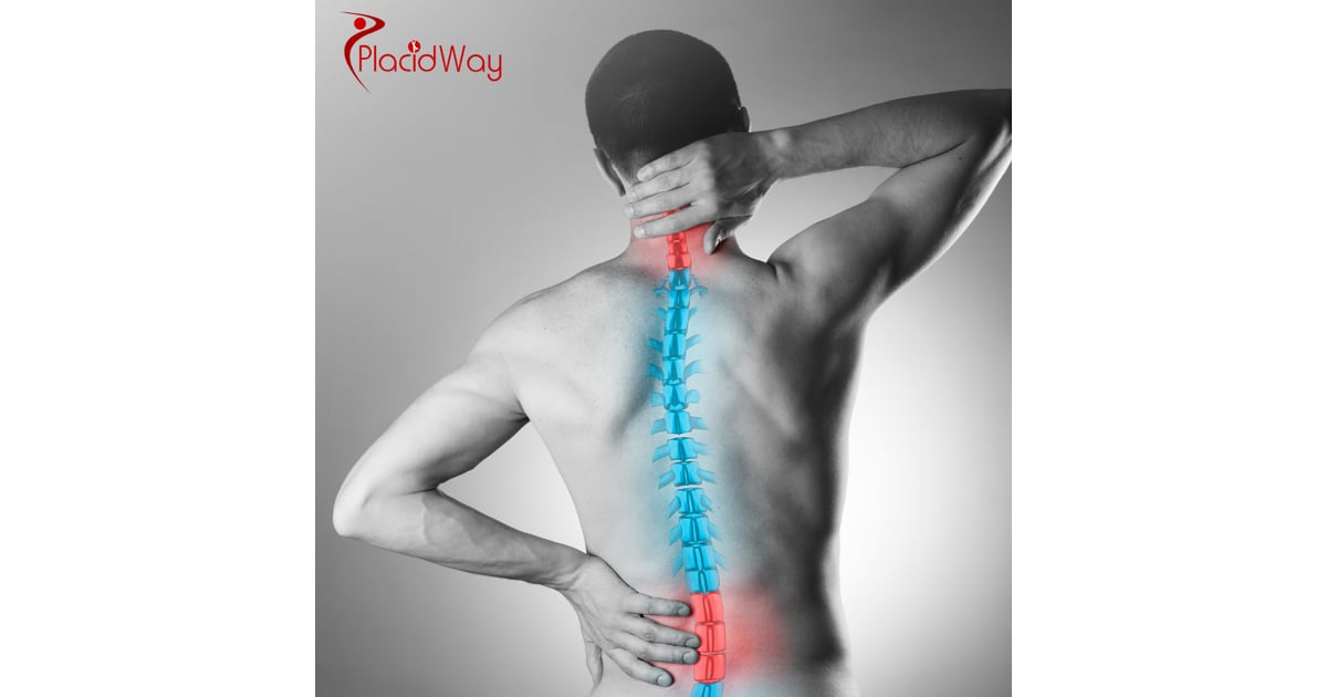 Herniated Disc Surgery in Turkey: A UK Guide to Microdiscectomy