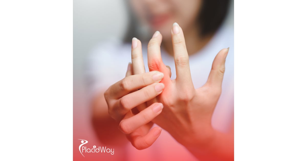 Stem Cell Therapy for Rheumatoid Arthritis in Turkey: A UK Patient's Guide to Treatment
