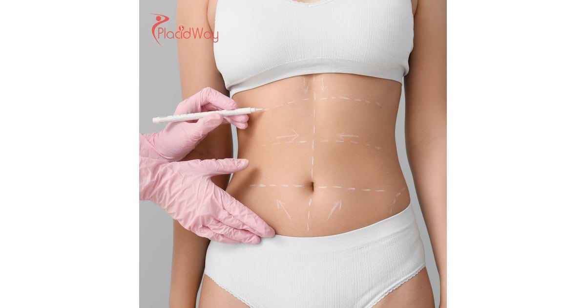 Vaser Liposuction in Istanbul: A UK Guide to Advanced Body Contouring