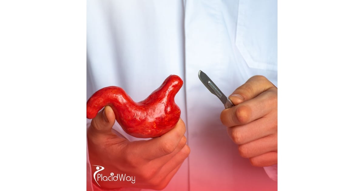 Choosing a Bariatric Surgeon in Turkey: A Checklist for UK Medical Tourists