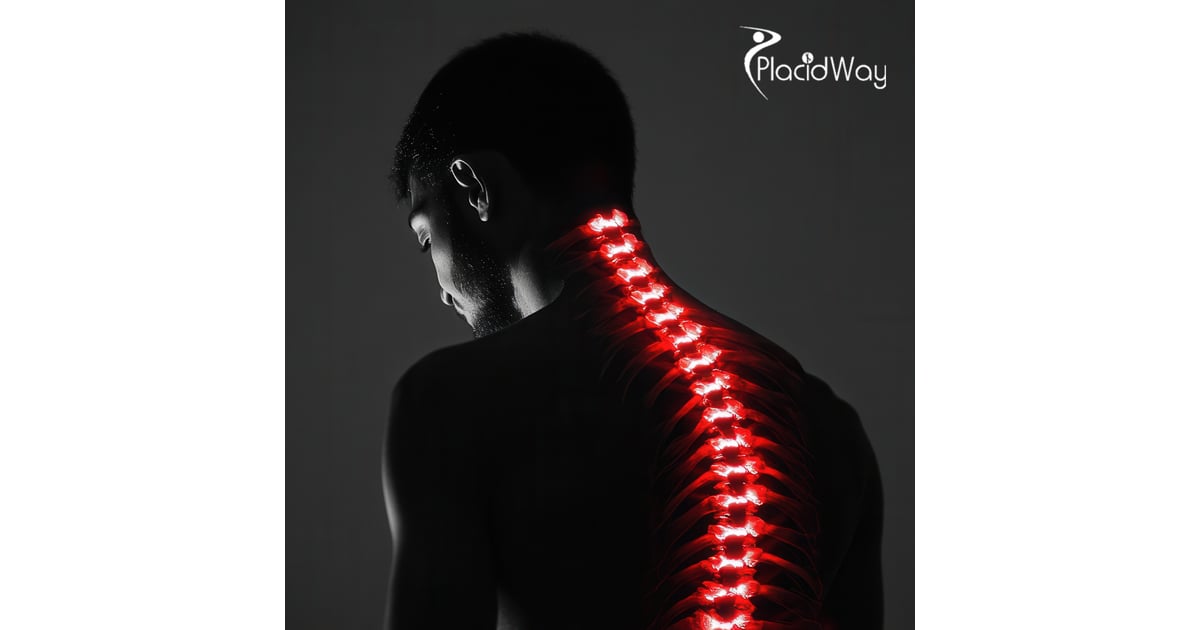 Spinal Cord Injury Stem Cell Therapy in Colombia: Low-Cost, Effective Solutions for Georgia Patients