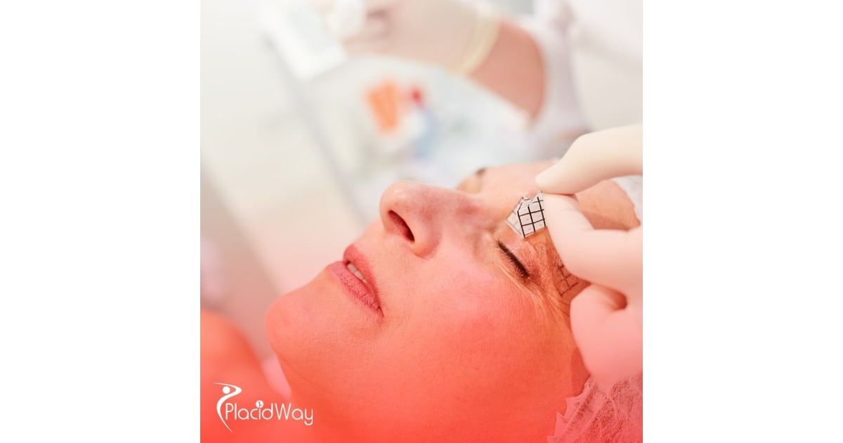 Eyelid Surgery in South Korea: Double Eyelid Surgery for U.S. Patients Seeking Affordable Solutions