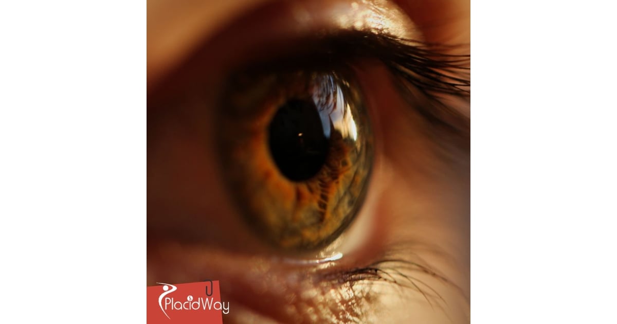 LASIK Eye Surgery in Turkey: The Popular Vision Correction Procedure for German Patients