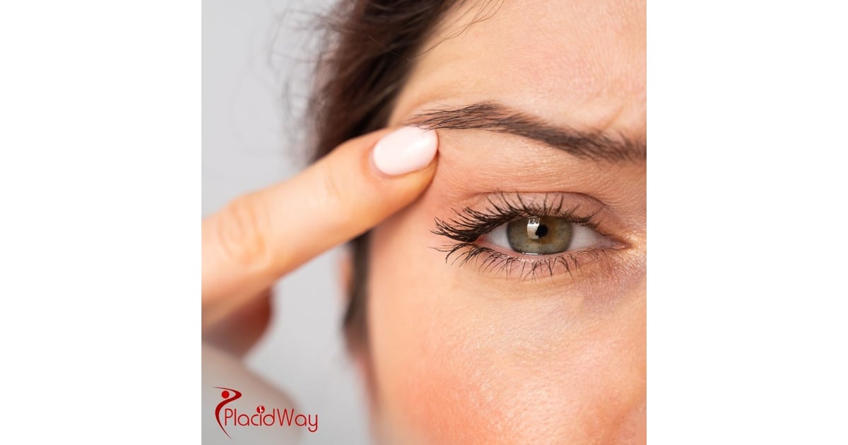Eyelid Surgery in Turkey: Blepharoplasty for German Patients Looking to Enhance Their Eyes