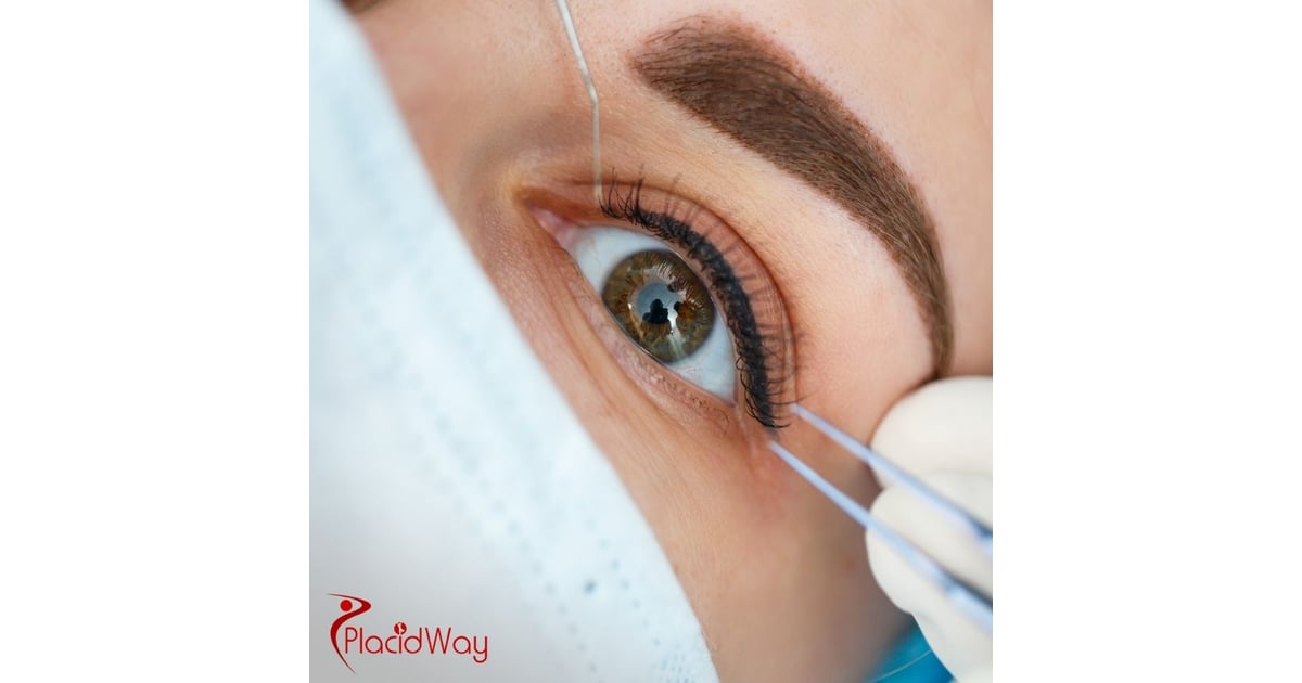 LASIK Eye Surgery in Mexico: Affordable Vision Correction for New Mexico Tourists