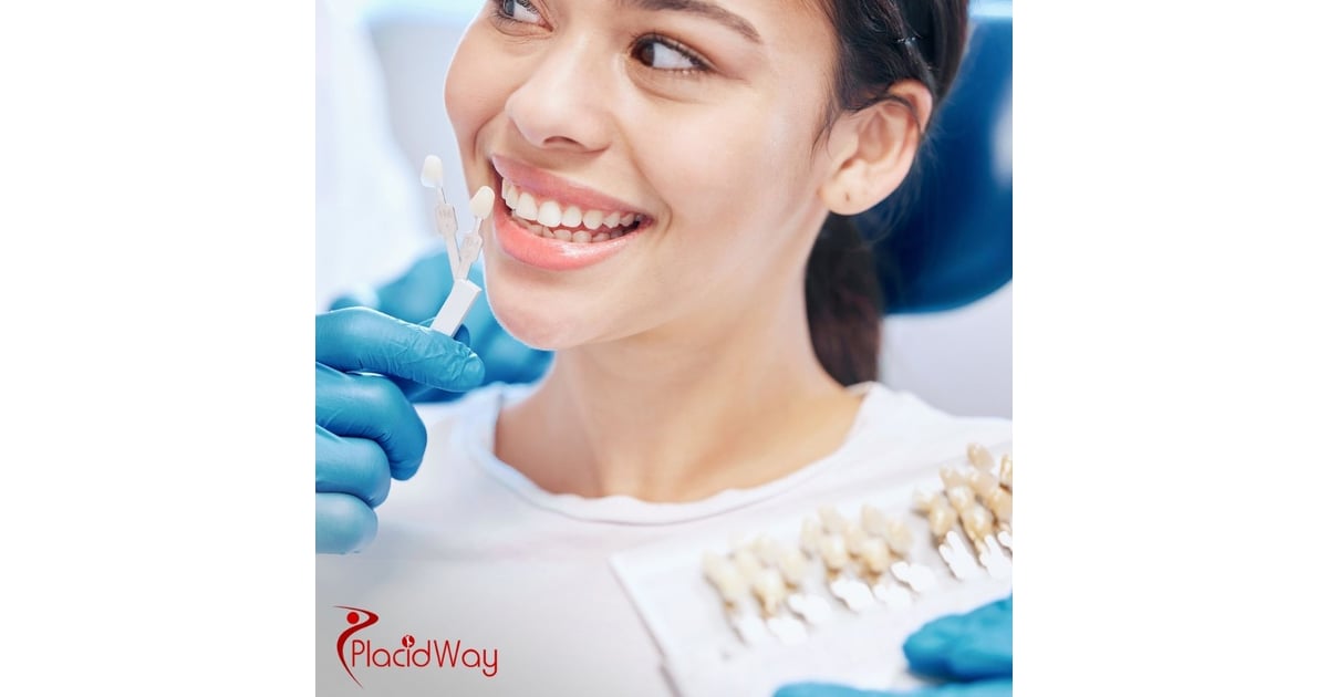 Veneers in Costa Rica: Affordable Cosmetic Dentistry for California Tourists
