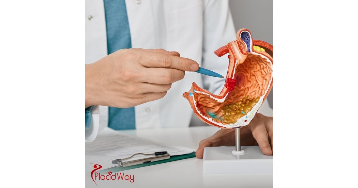 Gastric Bypass in Mexico: Safe, Cost-Effective Surgery for California Tourists