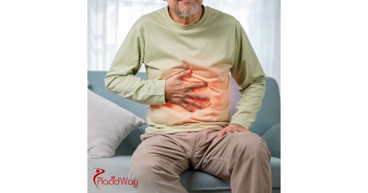 Gastric Sleeve Surgery in Turkey: The Affordable Weight Loss Solution for German Patients