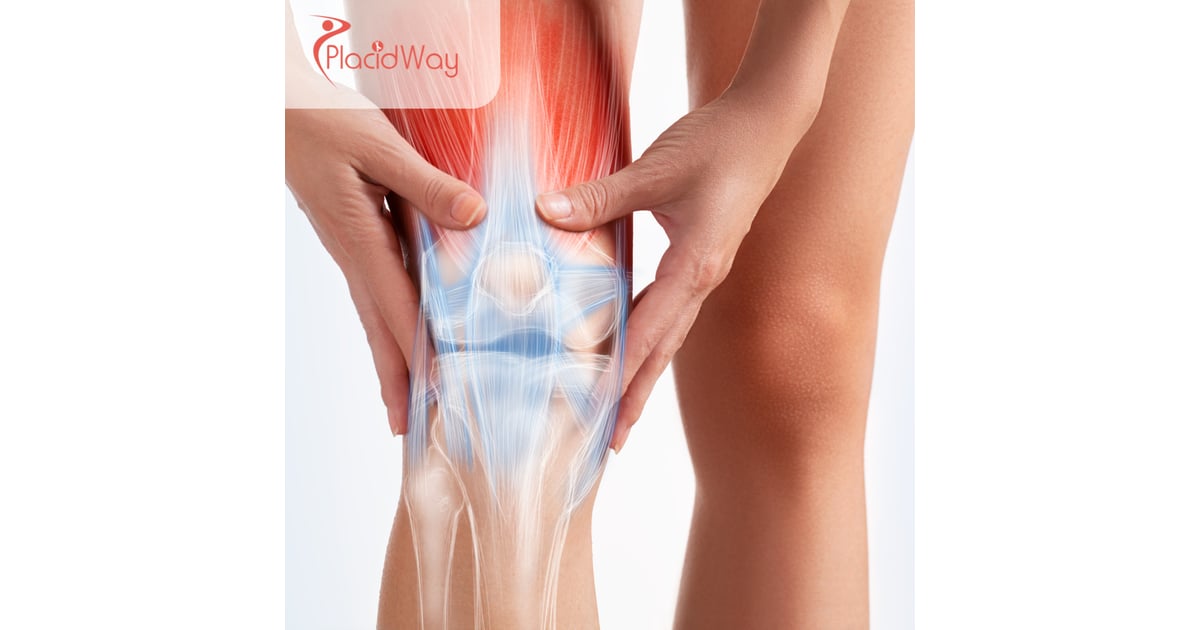 Knee Replacement Surgery in Mexico: High-Quality, Affordable Joint Surgery for Texas Patients