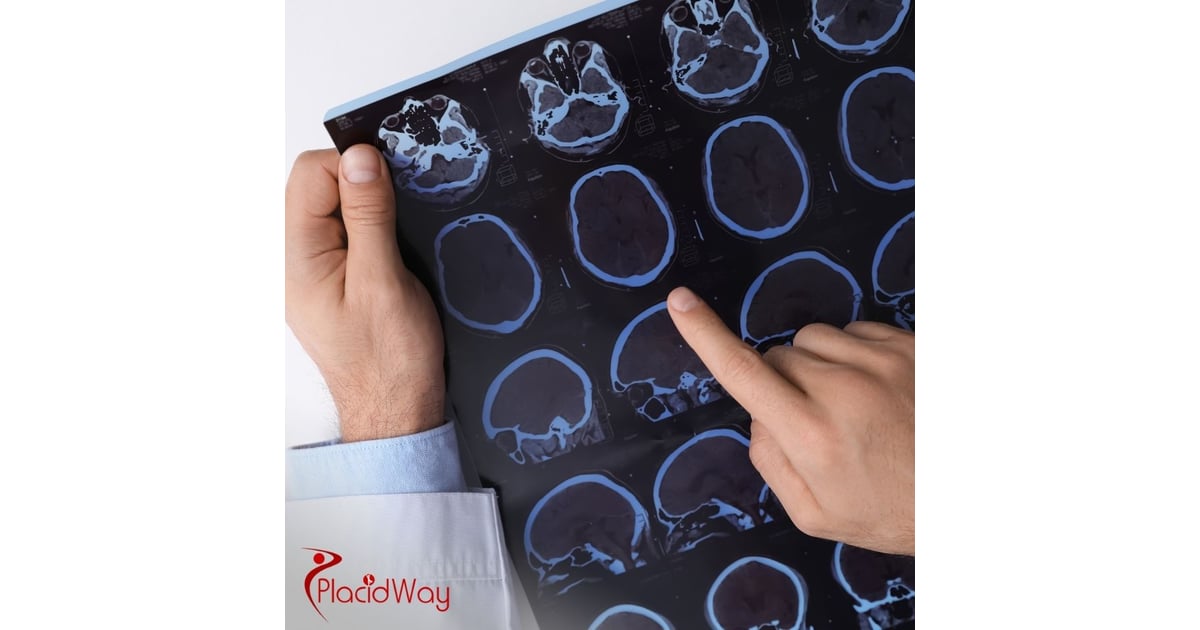 Multiple Sclerosis Stem Cell Treatments in Colombia: Affordable Options for California Tourists