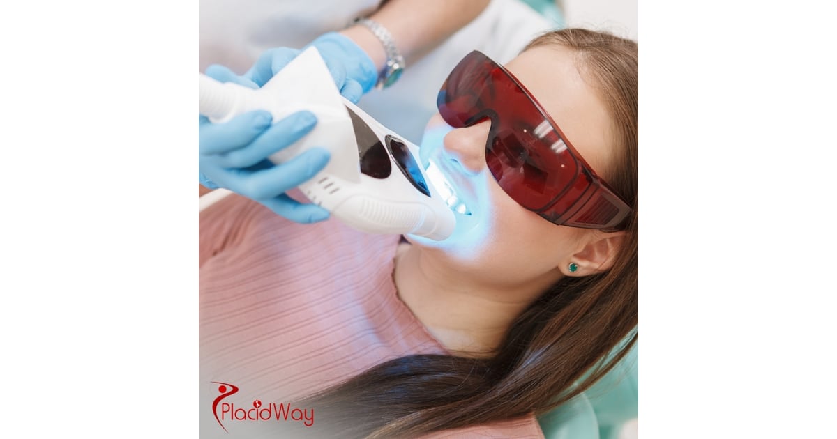 Teeth Whitening in Turkey: A Safe and Effective Option for German Tourists Seeking a Brighter Smile