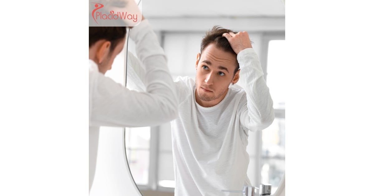 Affordable Hair Transplant in Turkey: UK Patient’s Cost & Travel Guide