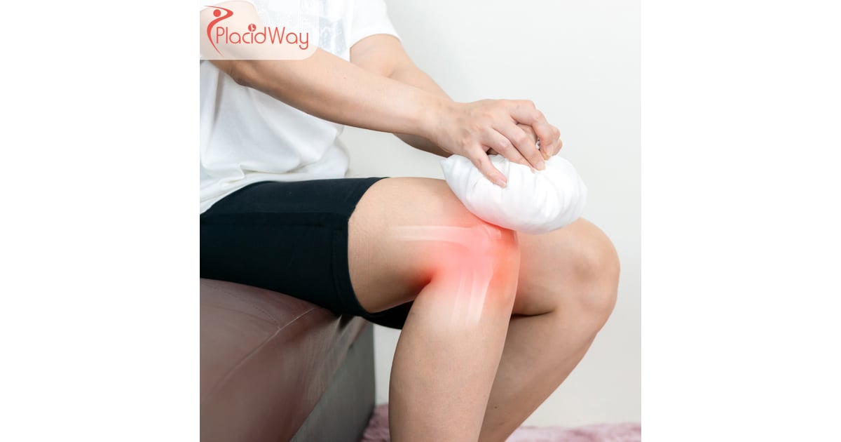 Stem Cell Therapy for Osteoarthritis in Turkey: Costs and Options for UK Patients