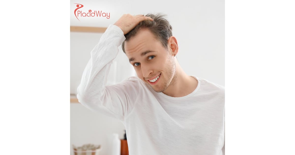 Direct Hair Implantation (DHI) in Turkey: A Complete Guide for Americans Looking for Advanced Hair Restoration