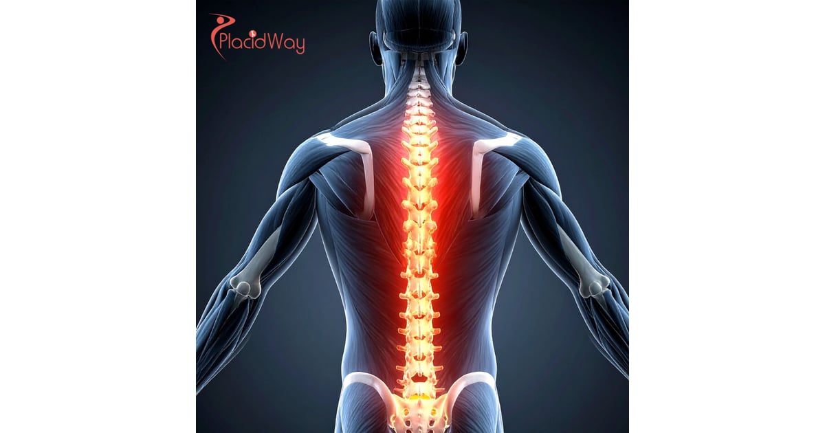 Spinal Fusion Surgery in Colombia: High-Quality Orthopedic Care for U.S. Patients at Lower Costs
