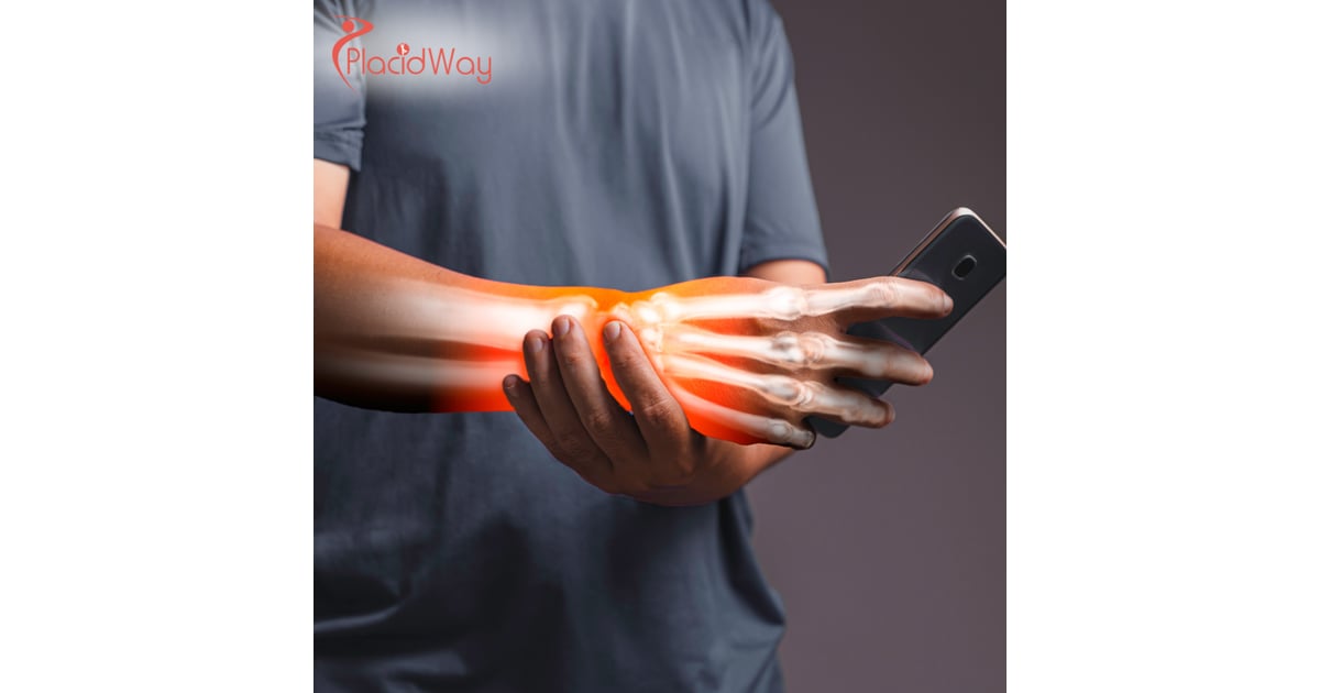 Carpal Tunnel Surgery in Turkey: Key Information for Canadian Patients