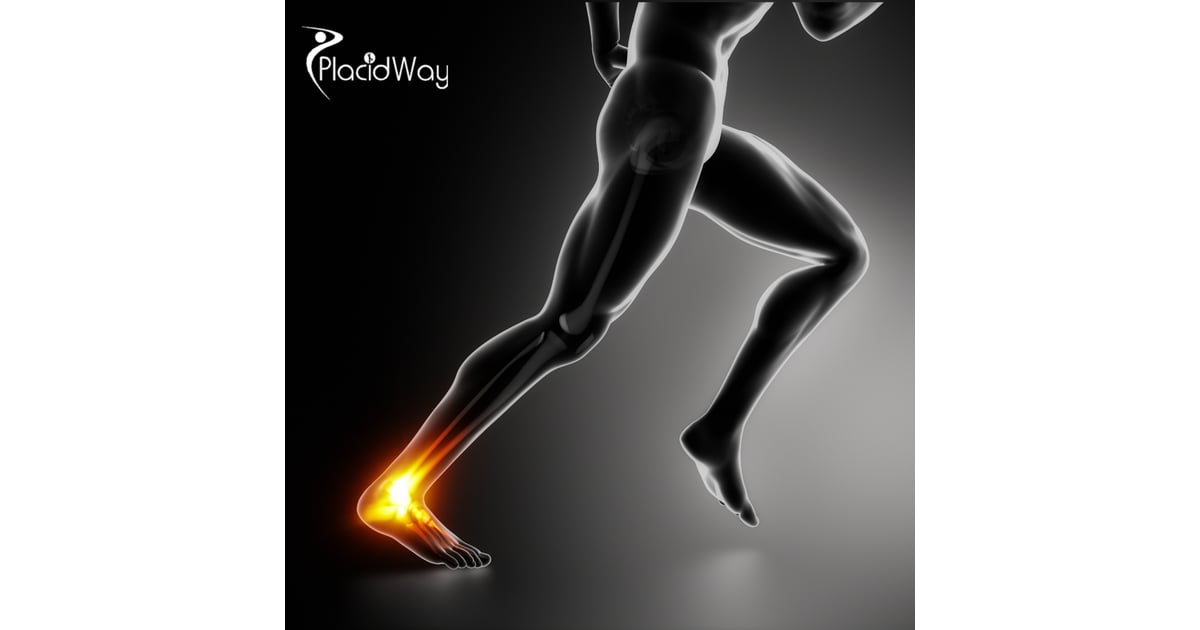 Achilles Tendon Repair in Mexico: Advanced Care for Australian Patients 