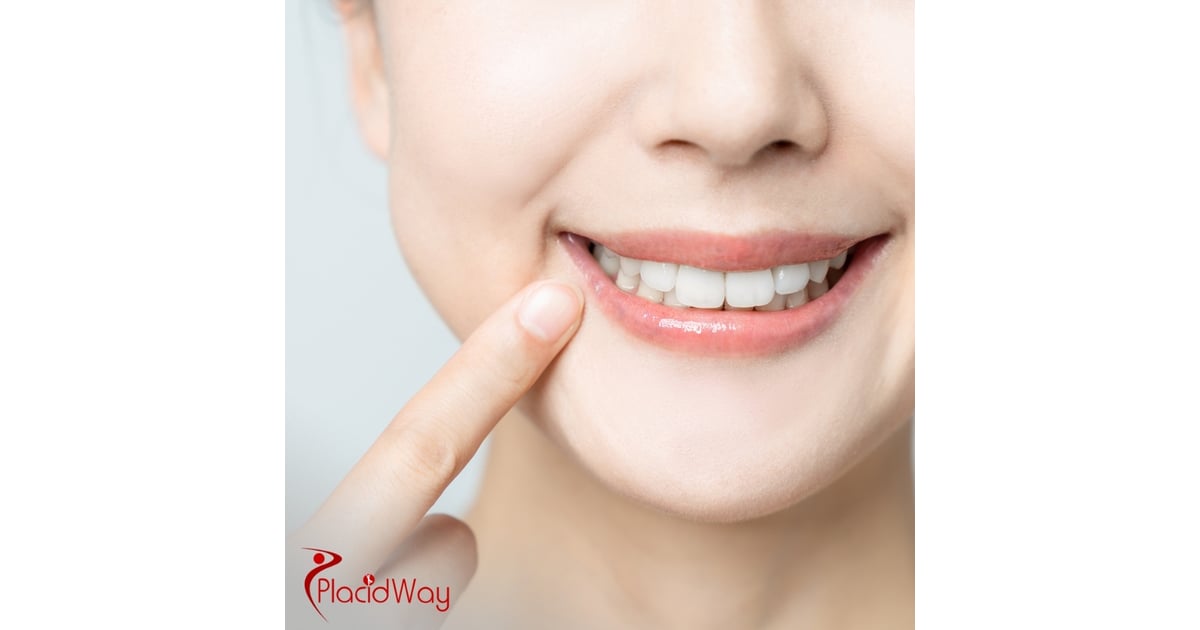All-on-4 Dental Implants Cost in Thailand: Why Patients Choose Bangkok and Phuket