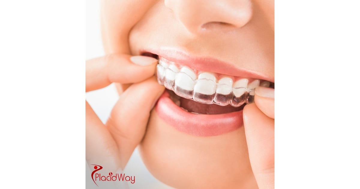 Dental Treatment in South Korea: Explore Costs, Top Clinics, and Procedures