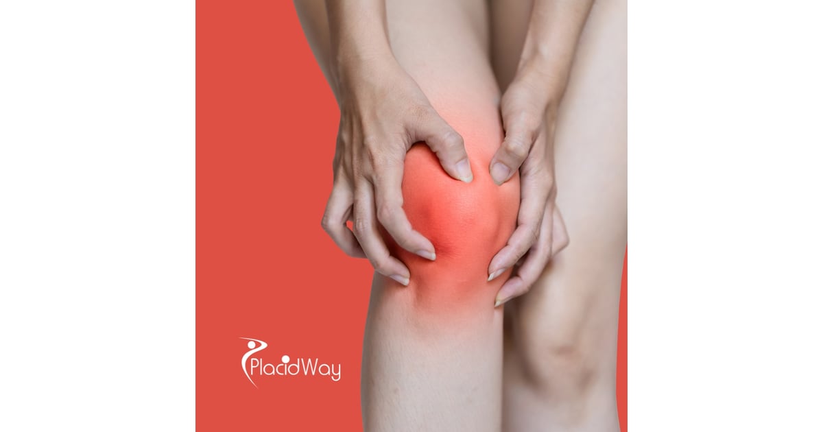 Stem Cell Therapy in Turkey for Rheumatoid Arthritis: Top Clinics and Benefits for Middle Eastern Patients