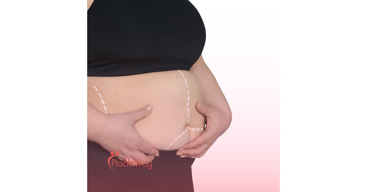 Bariatric Surgery in Turkey: Life-Changing Weight Loss Surgery for Qatar Patients with Type 2 Diabetes
