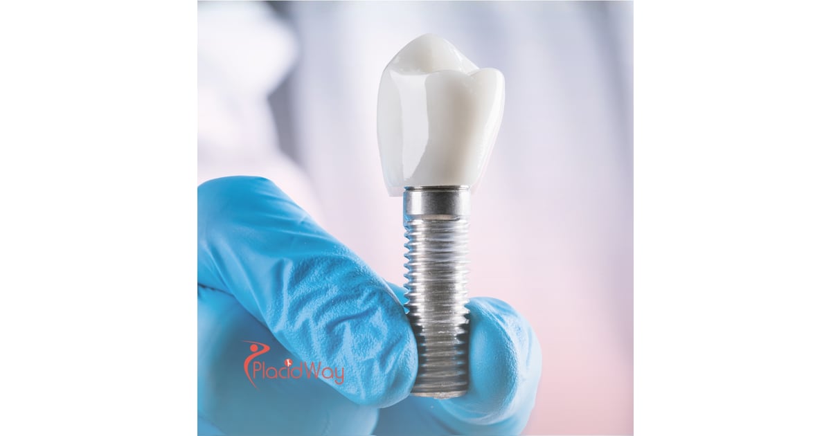 Get the Best Dental Implants in Los Algodones, Mexico: A Complete Guide for Californians