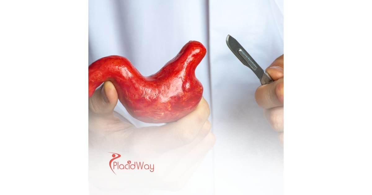 Gastric Sleeve Surgery in Istanbul: Weight Loss Solutions for Birmingham Patients