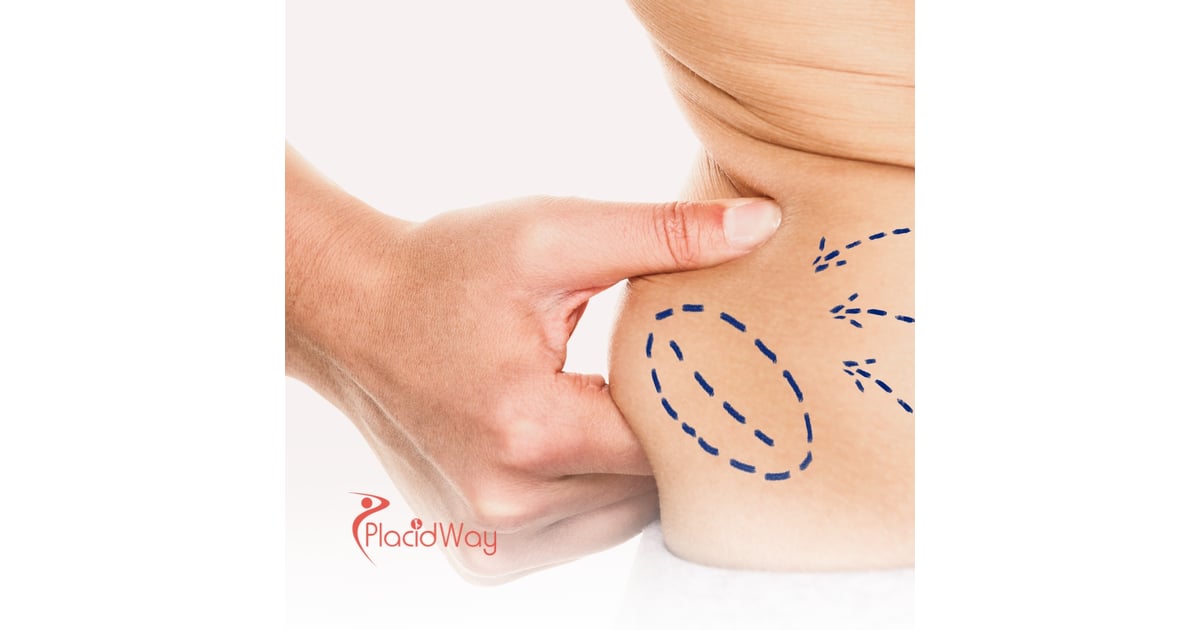 Why Mexicali, Mexico is the Top Choice for Affordable Liposuction for Arizona Residents