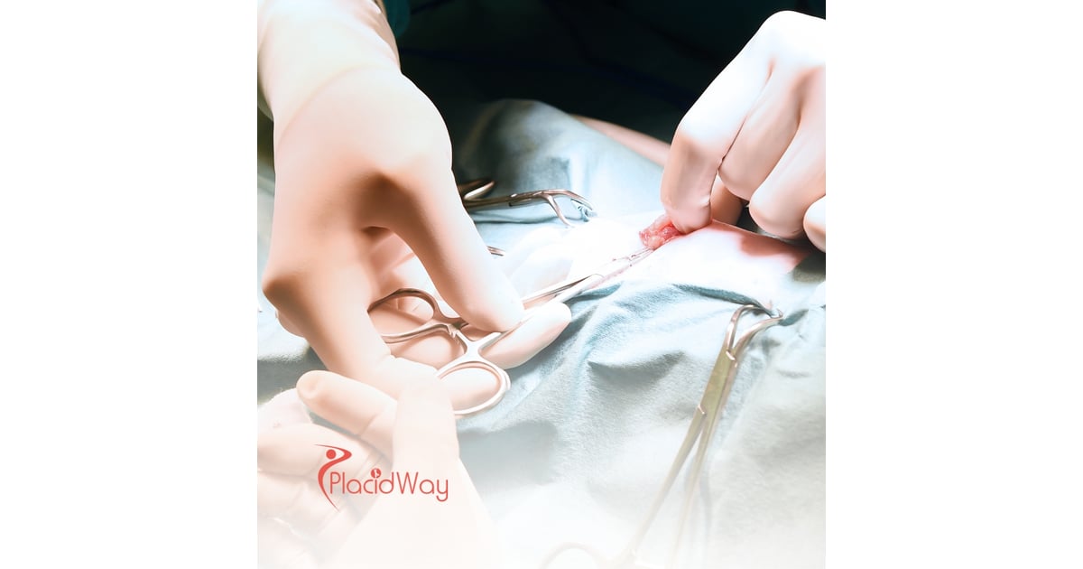 Penile Surgery in Germany: High-Quality Urology Services for Middle Eastern Men with Erectile Dysfunction