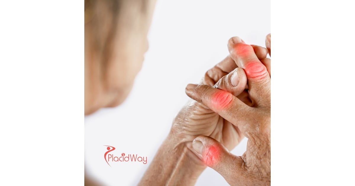 How Stem Cell Therapy in Thailand is Helping New Zealanders with Arthritis