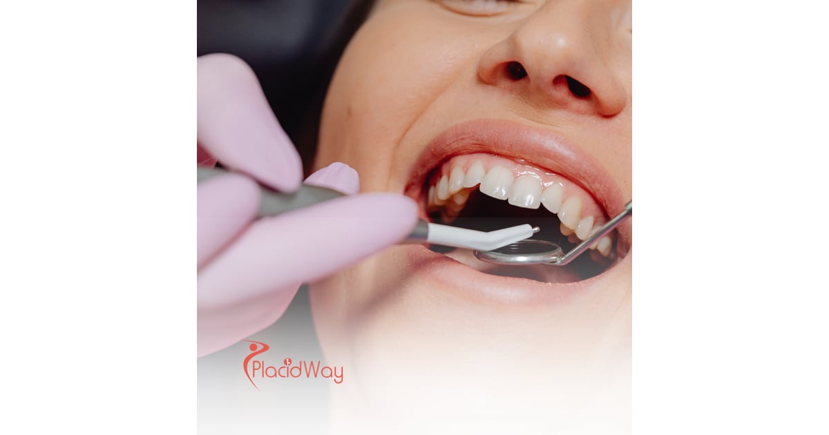 How to Save on Full Mouth Restoration in Thailand as a New Zealand Resident