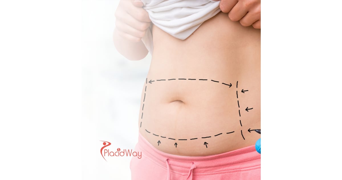 Liposuction in Colombia: Why Bahamian Patients Choose Colombia for Body Contouring