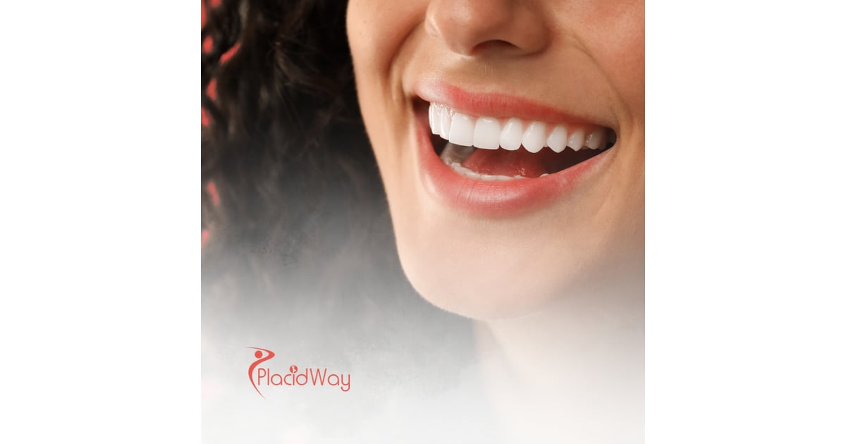 Cosmetic Dentistry in Colombia: Best Veneers and Smile Makeovers for Puerto Rican Patients