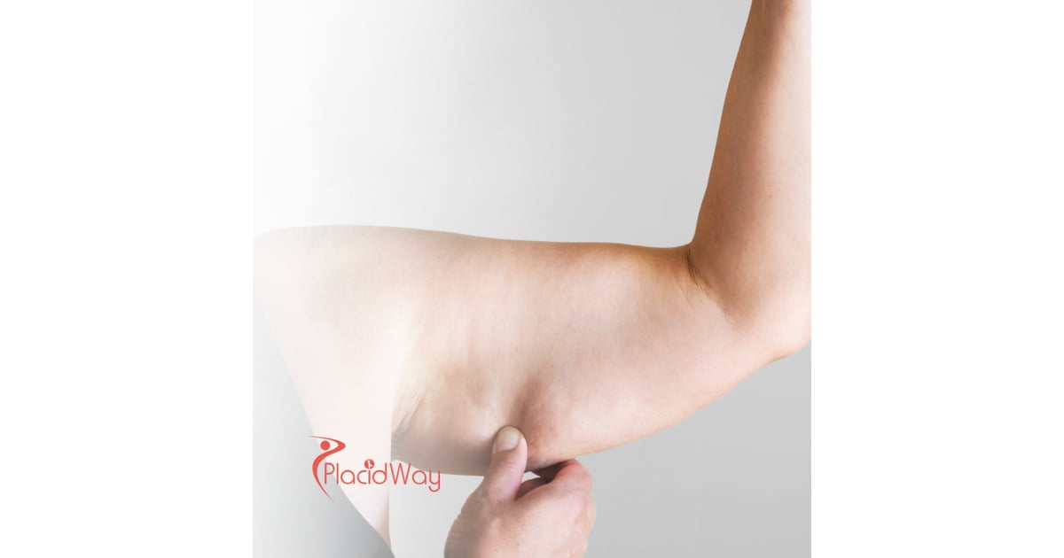 Thailand’s Popular Liposuction Options: A Budget-Friendly Choice for New Zealand Patients