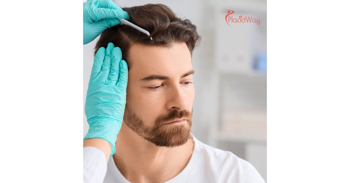 Terapia con células madre para la caída del cabello en Colombia: La mejor opción para los residentes de Trinidad y Tobago