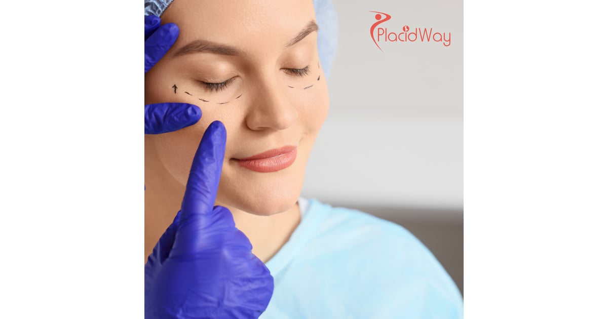 Exploring Thailand for Eyelid Surgery: A Popular Option for New Zealanders