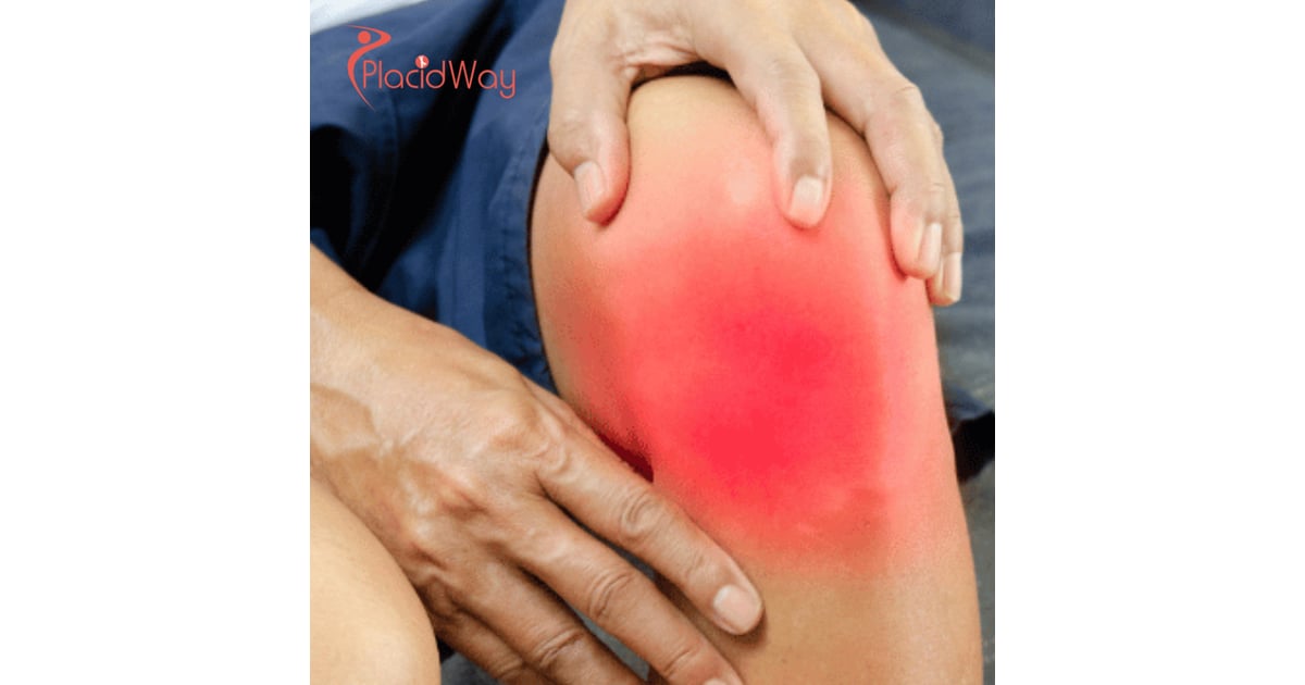 Affordable Stem Cell Therapy for Knee Pain in Germany for UK Patients from London