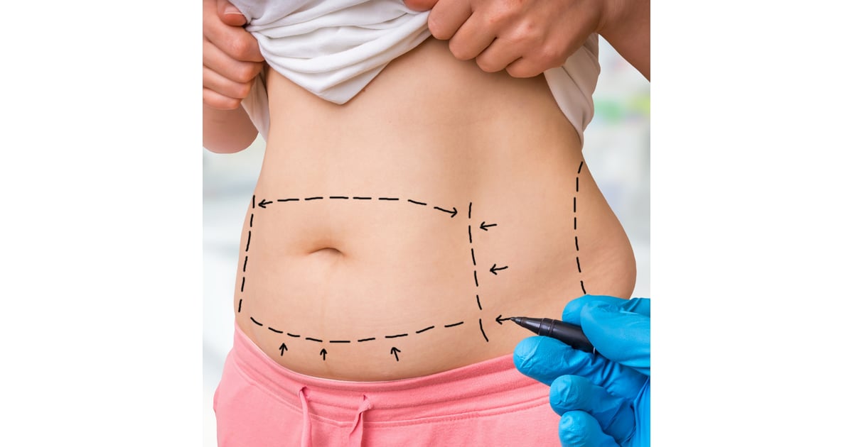 Liposuction from Vancouver to Tijuana, Mexico – Transform Your Look Abroad